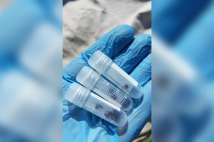 Во Владимирской области клещи укусили 117 человек