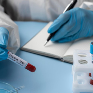 Во Владимирской области выявили 1006 случаев ковида