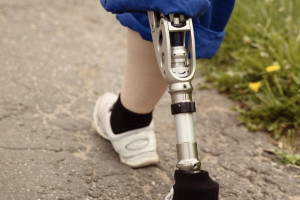 Прокуратура пресекла покупку ржавых протезов для инвалидов во Владимирской области