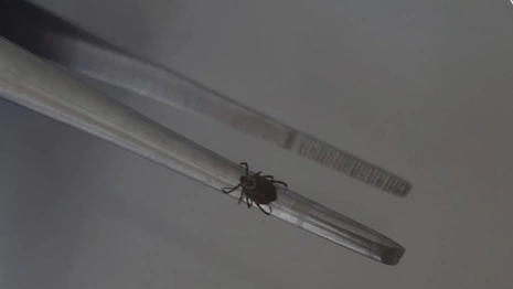 С людей во Владимирской области сняли 5 зараженных вирусами клещей