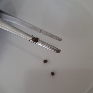 Во Владимирской области сняли клещей с 17 детей