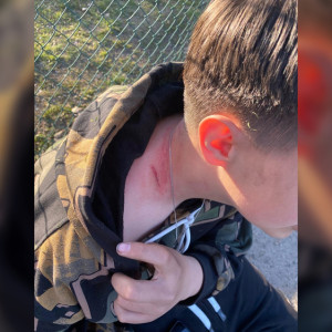 Во Владимирской области избиение подростка отцом с сыном обернулось уголовным делом