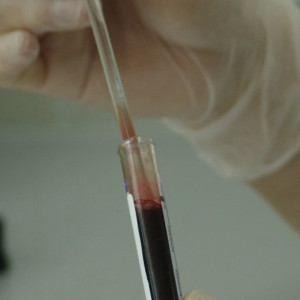 Онкобольные стали в два раза чаще лечиться во Владимирской области