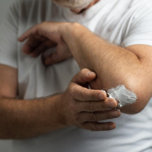 Во Владимире 31-летнего мужчину увезли в больницу с химическим ожогом