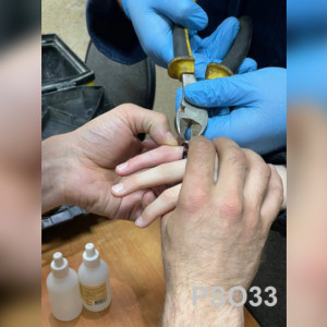 Во Владимире у 12-летнего мальчика палец застрял в кольце