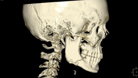 Владимирские врачи спасли подростка после избиения в новогодние каникулы