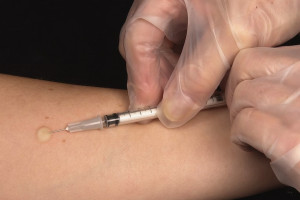 В Судогде экс-заключенные отказались проверяться на туберкулез