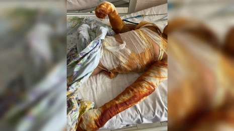 Малыша с ожогами 40% тела доставили на вертолете из Владимира в Нижний Новгород