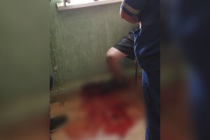 Во Владимире спасли жизнь двоим порезавшим себя мужчинам