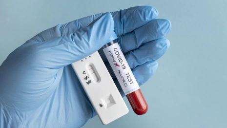 Во Владимирской области санврачи подтвердили 57 новых случаев COVID-19