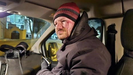 В Суздале гужевая повозка сбила московского корреспондента