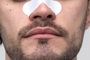 Откусивший нос человеку житель Вязников избежал реального срока