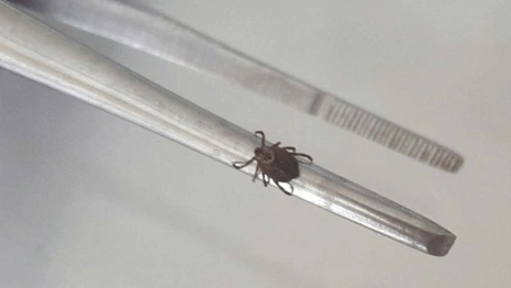 Клещи укусили 168 жителей Владимирской области за неделю