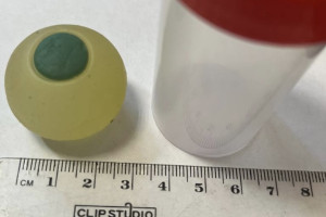 В Челябинске 9-летний ребенок перепутал силиконовый глаз с мармеладным и проглотил его