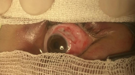 Владимирские врачи спасли 8-летнюю девочку после падения на нее ледяной глыбы