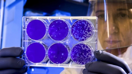 Во Владимирской области заболеваемость ковидом выросла до 33 случаев
