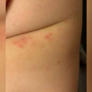 Мама из Владимира рассказала о переболевшем вирусом Коксаки ребенке