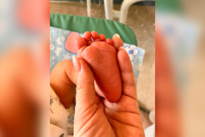 Во Владимире врачи спасли рожениц с гигантскими миомами и их детей