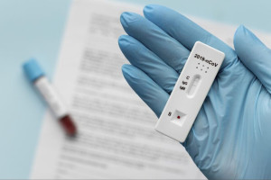 Во Владимирской области ковидом заразились 123 пациента