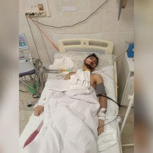 Житель Коврова впал в кому после жестокого избиения