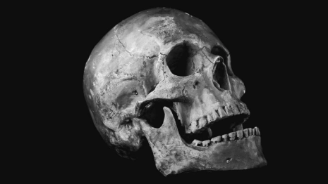 Между корпусами больницы во Владимире нашли два черепа и кости