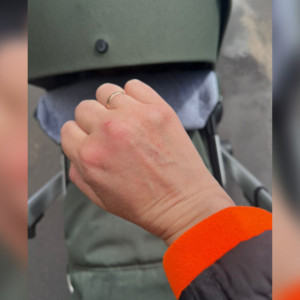 Во Владимире хулиганы из окна сбросили куриное яйцо на женщину с коляской