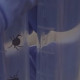 Во Владимирской области с людей сняли четырех зараженных болезнью Лайма клещей
