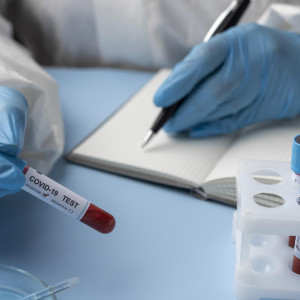 Во Владимирской области подтвердили 78 случаев COVID-19