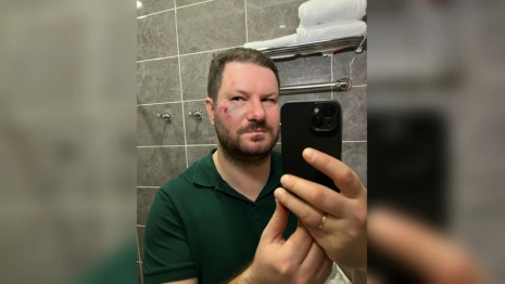 Сбитый в Суздале гужевой повозкой московский журналист записал видео