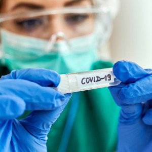 Заболеваемость ковидом во Владимирской области снизилась на 41,3%