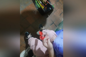 В Коврове у 4-летней девочки палец застрял в пластиковой игрушке