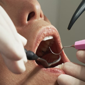 Семья из Коврова добилась компенсации от клиники за удаление здорового зуба у подростка