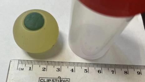 В Челябинске 9-летний ребенок перепутал силиконовый глаз с мармеладным и проглотил его