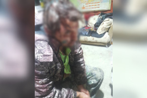 Война между соседями в селе под Камешково обернулась травмами для 3 человек