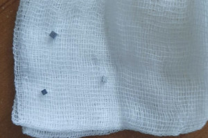 Владимирские врачи спасли проглотившего магниты годовалого малыша