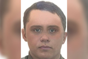 Во Владимирской области пропал 25-летний парень со шрамом над ухом