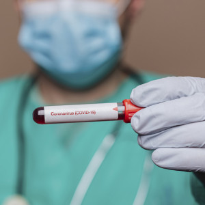 Во Владимирской области за сутки COVID-19 подтвердили у 20 пациентов