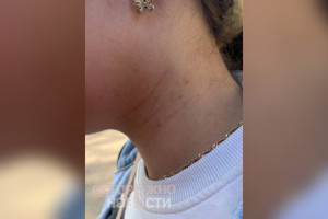 В Сети появились слухи об избиении детей группой подростков в Карабаново