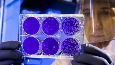 Владимирские санврачи назвали города с максимальным приростом COVID-19