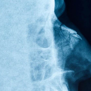 20-летний владимирец сломал полицейскому нос