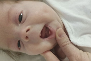 Во Владимире родился младенец с зубами