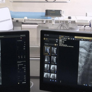 В Муромской больнице появился новый ангиограф