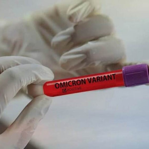 Во Владимирской области за сутки выявили 604 случая ковида