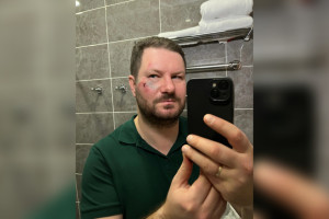 Сбитый в Суздале гужевой повозкой московский журналист записал видео