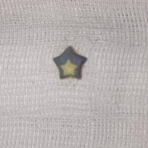 Во Владимире 2-летний ребенок проглотил пластиковую звездочку