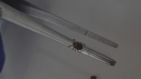 За неделю от укусов клещей пострадали 174 жителя Владимирской области