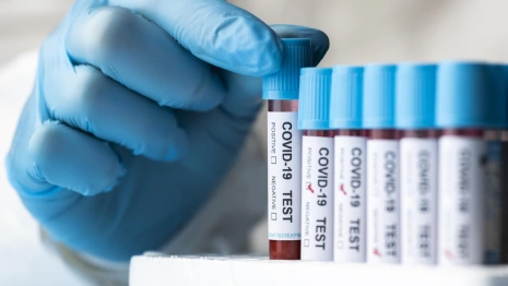 Во Владимирской области санврачи рассказали о 33 новых случаях COVID-19