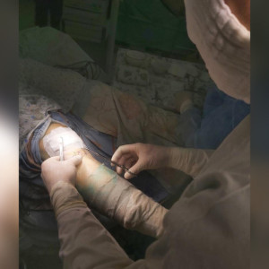 Во Владимире врачи помогли детскому футбольному тренеру вернуться к работе