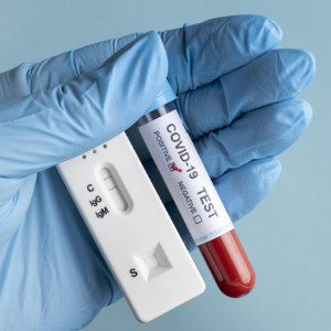 Во Владимирской области санврачи подтвердили 57 новых случаев COVID-19