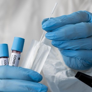 Во Владимирской области суточная заболеваемость COVID-19 выросла до 77 случаев